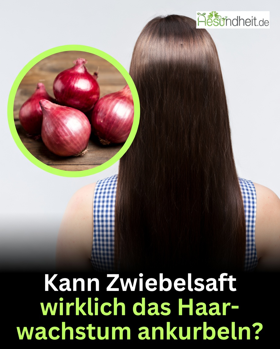 Wie man Zwiebelsaft für die Haarpflege vorbereitet: Tipps für einen einfachen Ansatz zu Hause