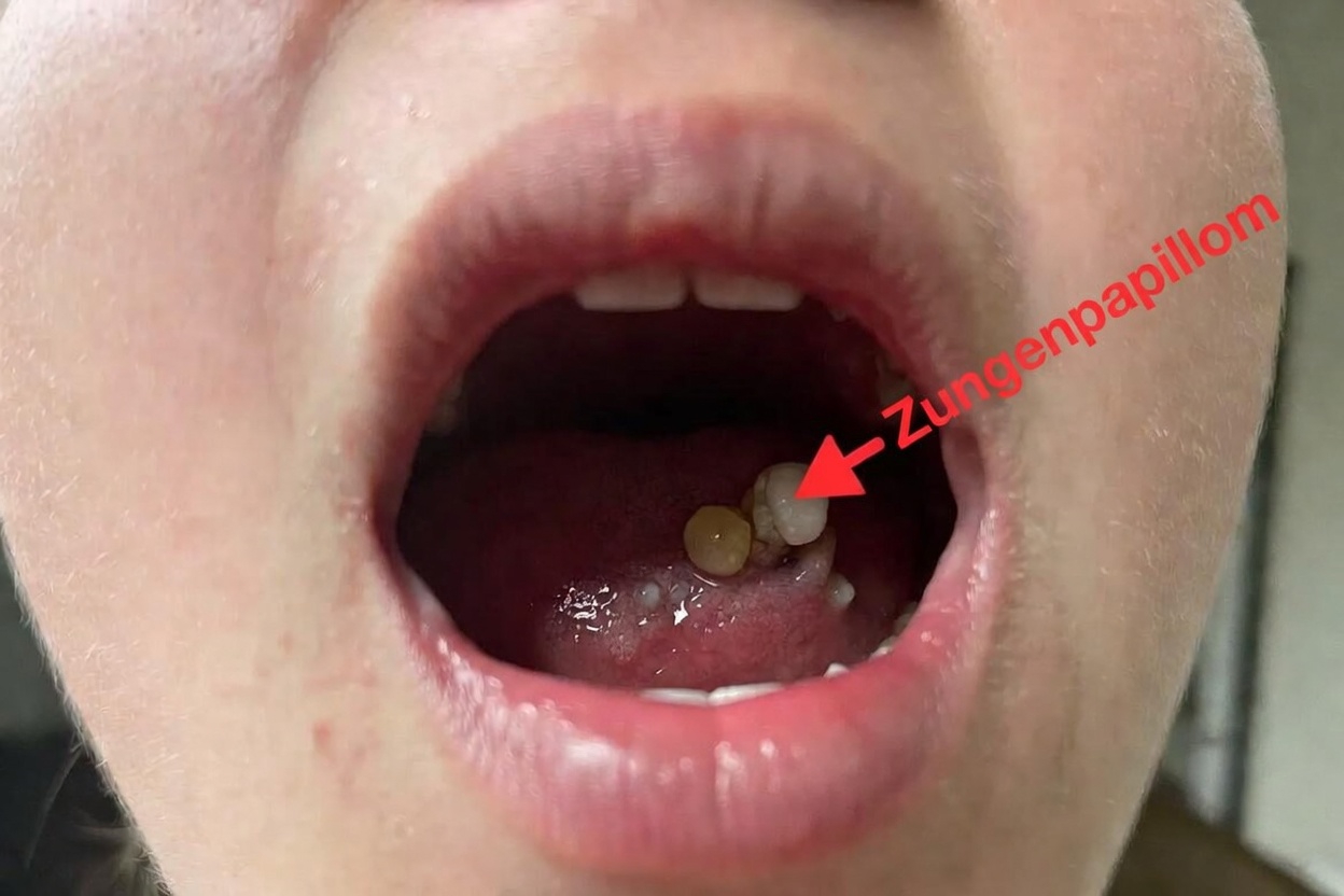 Mandelsteine: Alles, was Sie wissen müssen