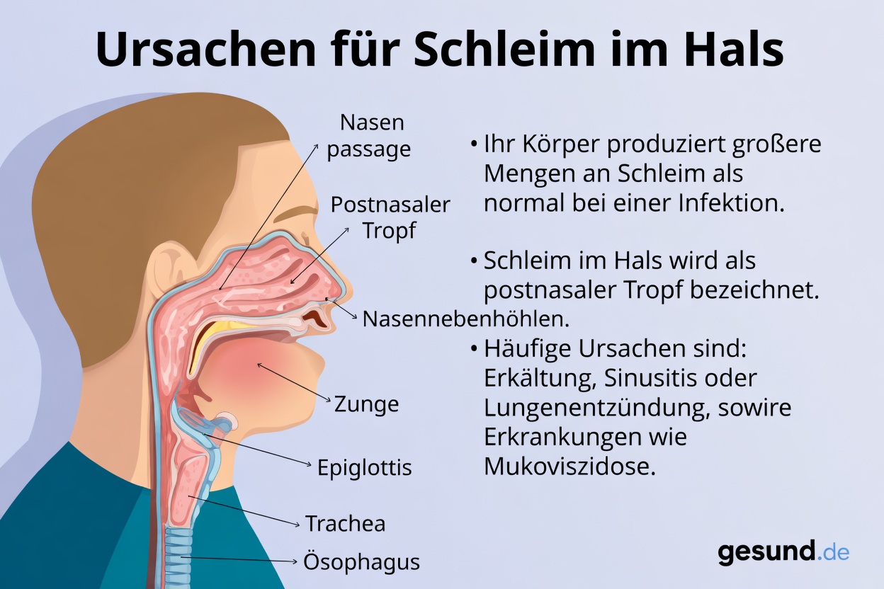 Warum sich Schleim und Auswurf so leicht ansammeln