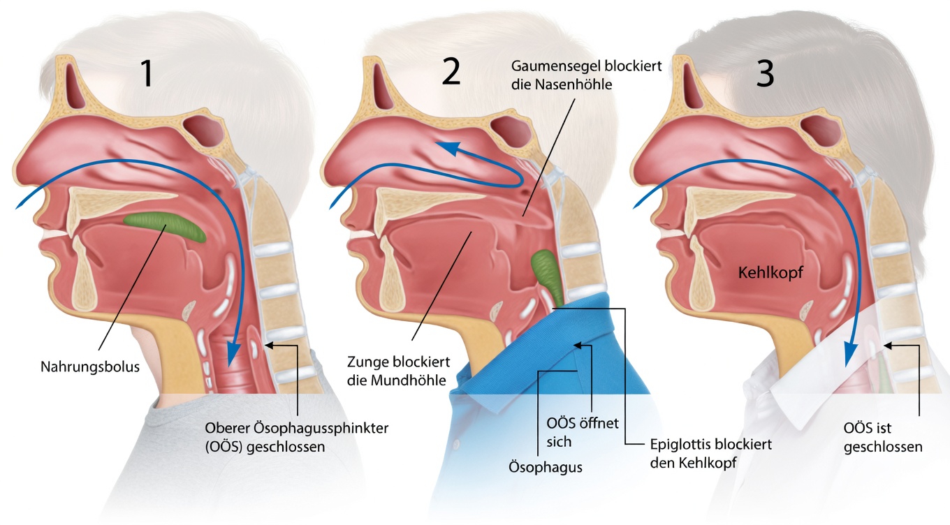 Warum sich Schleim und Auswurf so leicht ansammeln