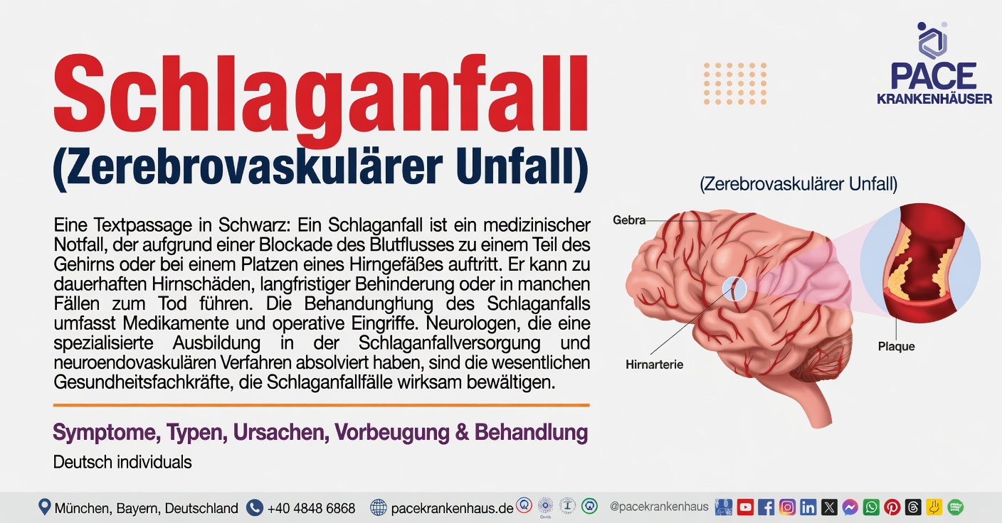 Könnte dieses Schlafsymptom ein Warnzeichen für einen Schlaganfall sein?