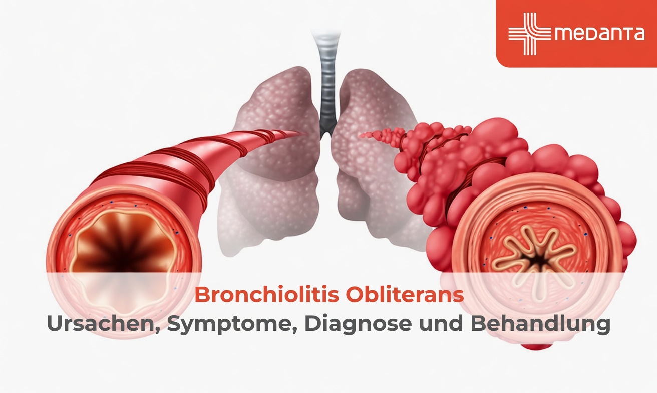 Vaping und Popcorn-Lunge: Ein stilles Risiko, das viele Erwachsene noch immer ignorieren