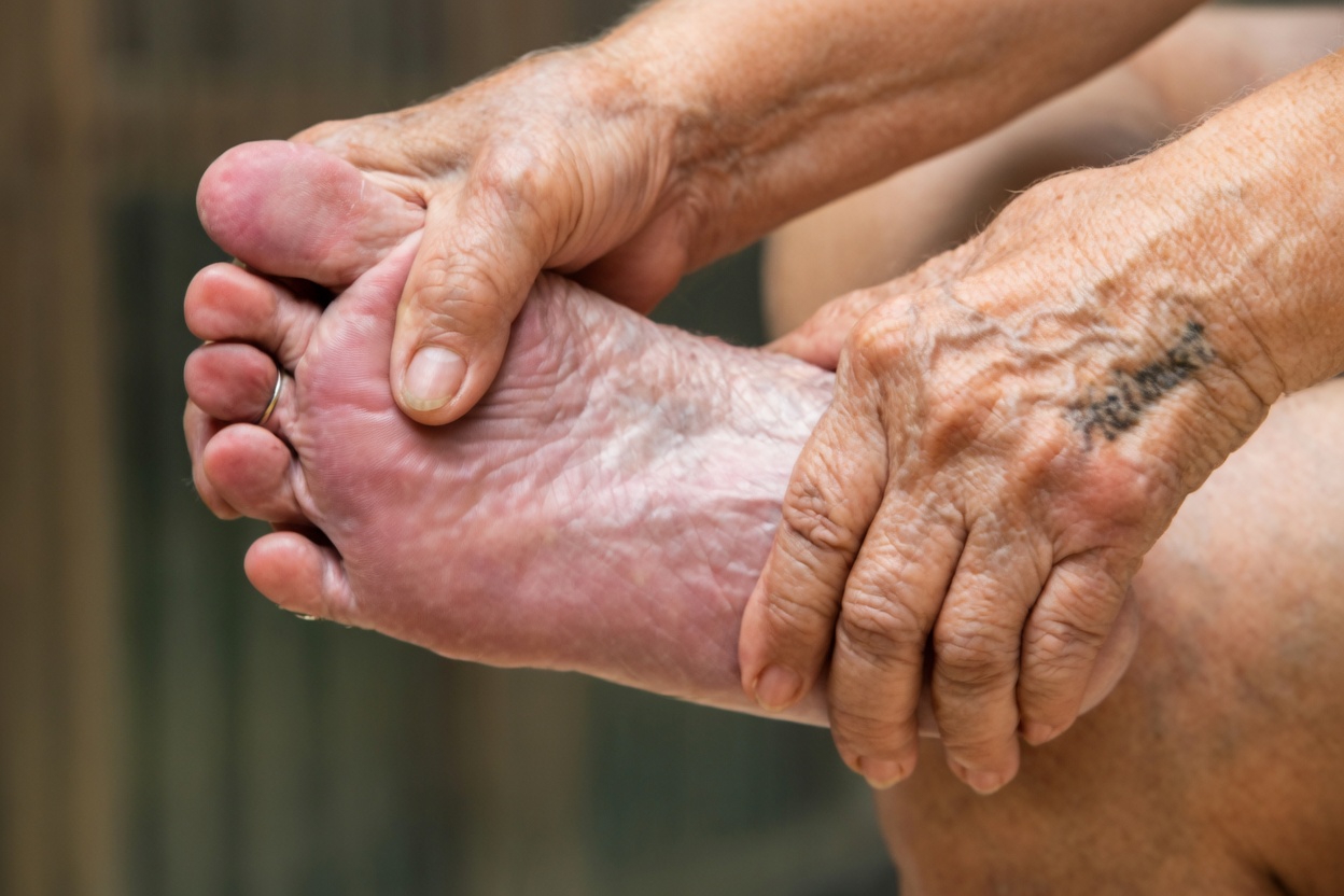 Könnten „harmlose“ Beinschmerzen ein Warnzeichen sein, das Sie nicht ignorieren sollten?