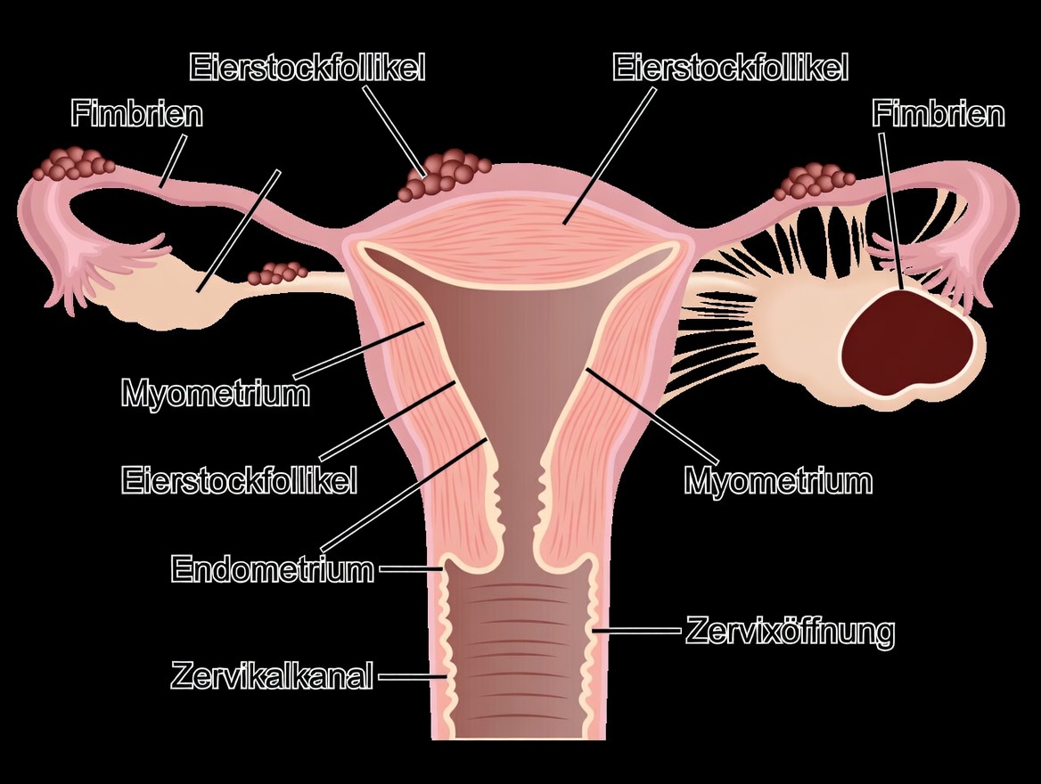 Endometriose-Warnung: Alltägliche Gewohnheiten, die Sie nicht ignorieren sollten