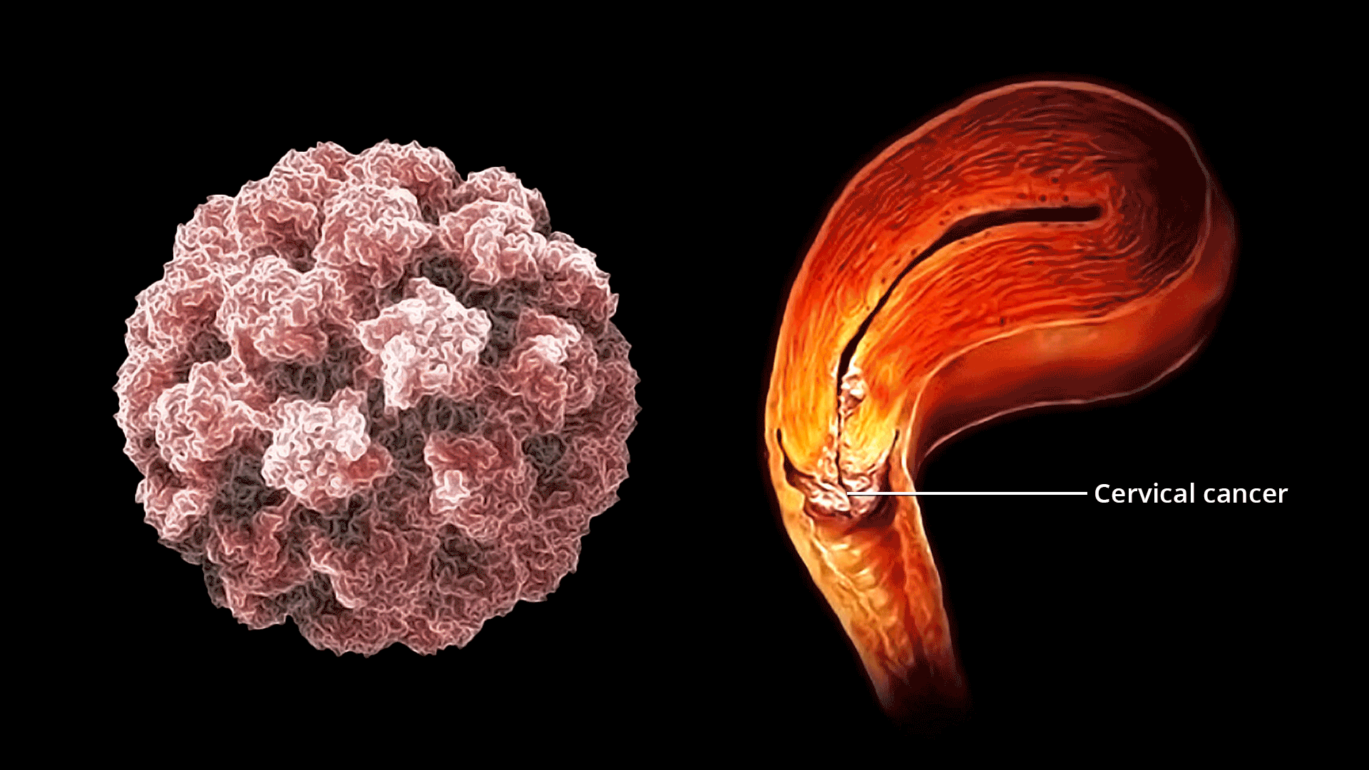Die kritischen Symptome von Gebärmutterhalskrebs, die jede Frau kennen und niemals ignorieren sollte