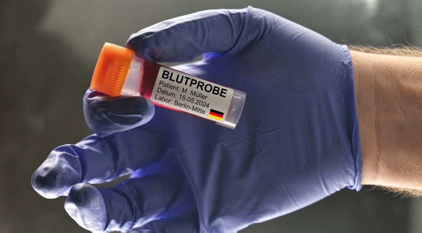 Entdecken Sie, welche Blutgruppe laut neuesten Forschungsstudien mit einem geringeren Krebsrisiko in Verbindung stehen könnte