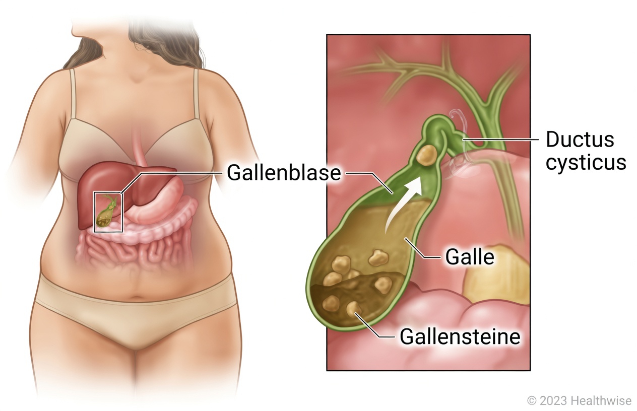 Entdecken Sie zwei alltägliche Gewohnheiten, die das Wohlbefinden der Gallenblase unterstützen können