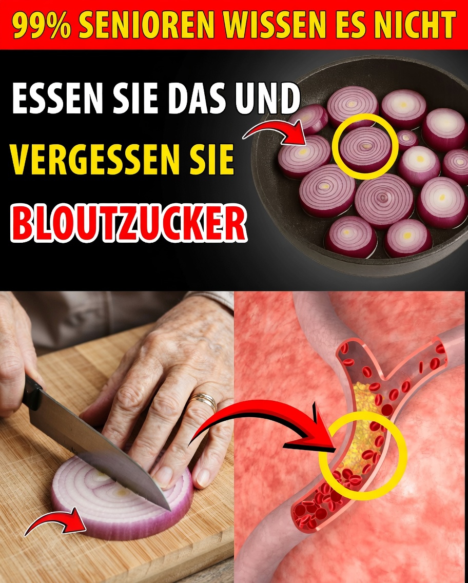 Senioren, würfeln Sie heute Abend EINE Zwiebel & trinken Sie dieses 60-Sekunden-Elixier, das den Blutzucker um 28 Punkte senkt, die Arterien blitzblank reinigt und Ihr Herz rettet – während Sie schlafen