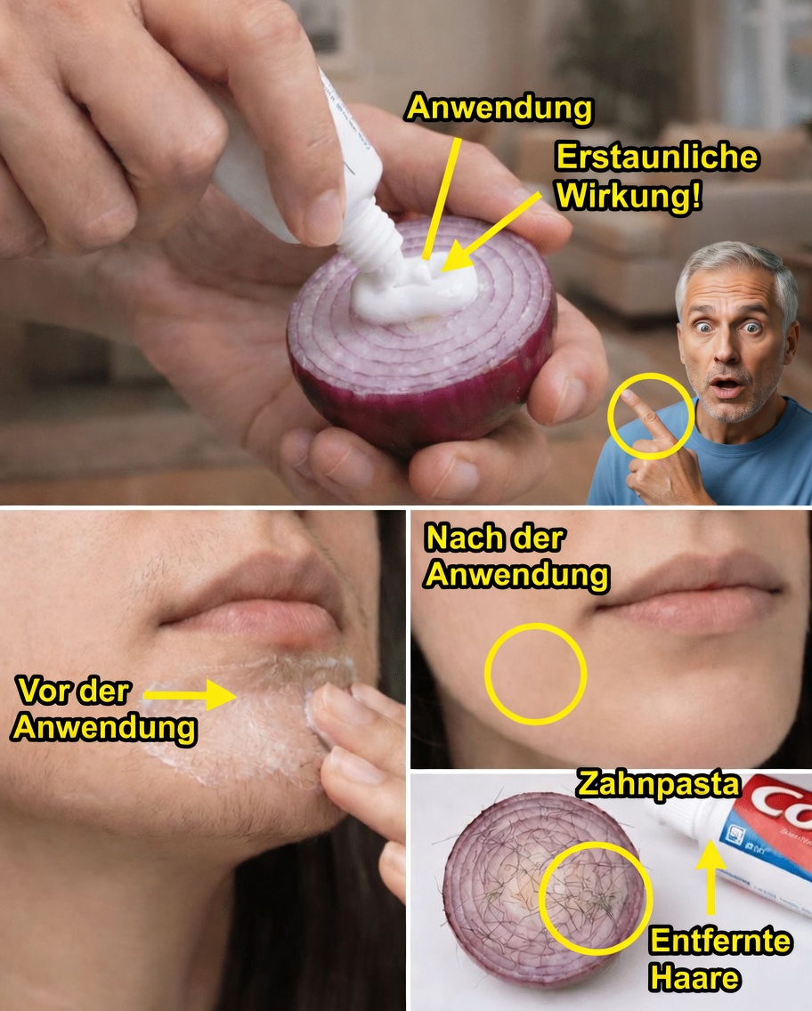 Weg mit dem Rasierer: Den Zahnpasta-und-Zwiebel-Trick für glattere Haut entdecken