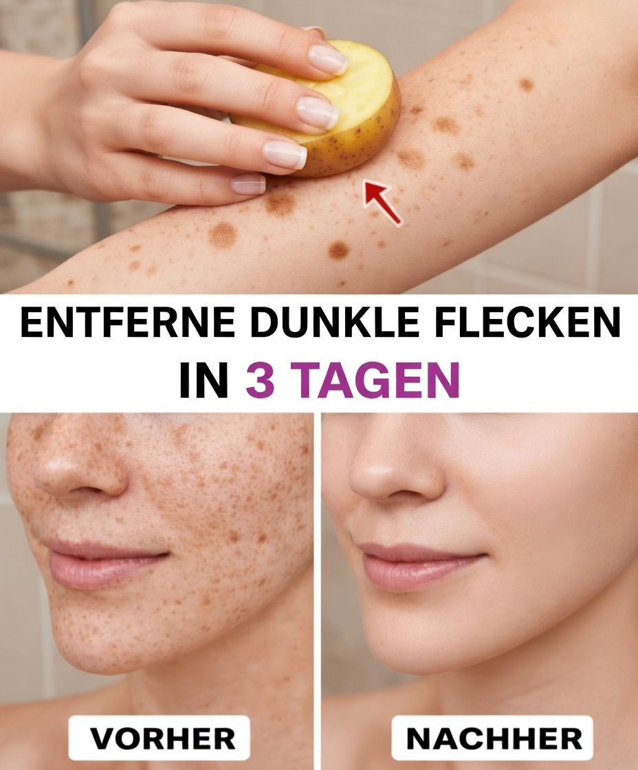 Beseitigen Sie Altersflecken, Melasma, Sonnenflecken, Hautunreinheiten und Anzeichen der Hautalterung.