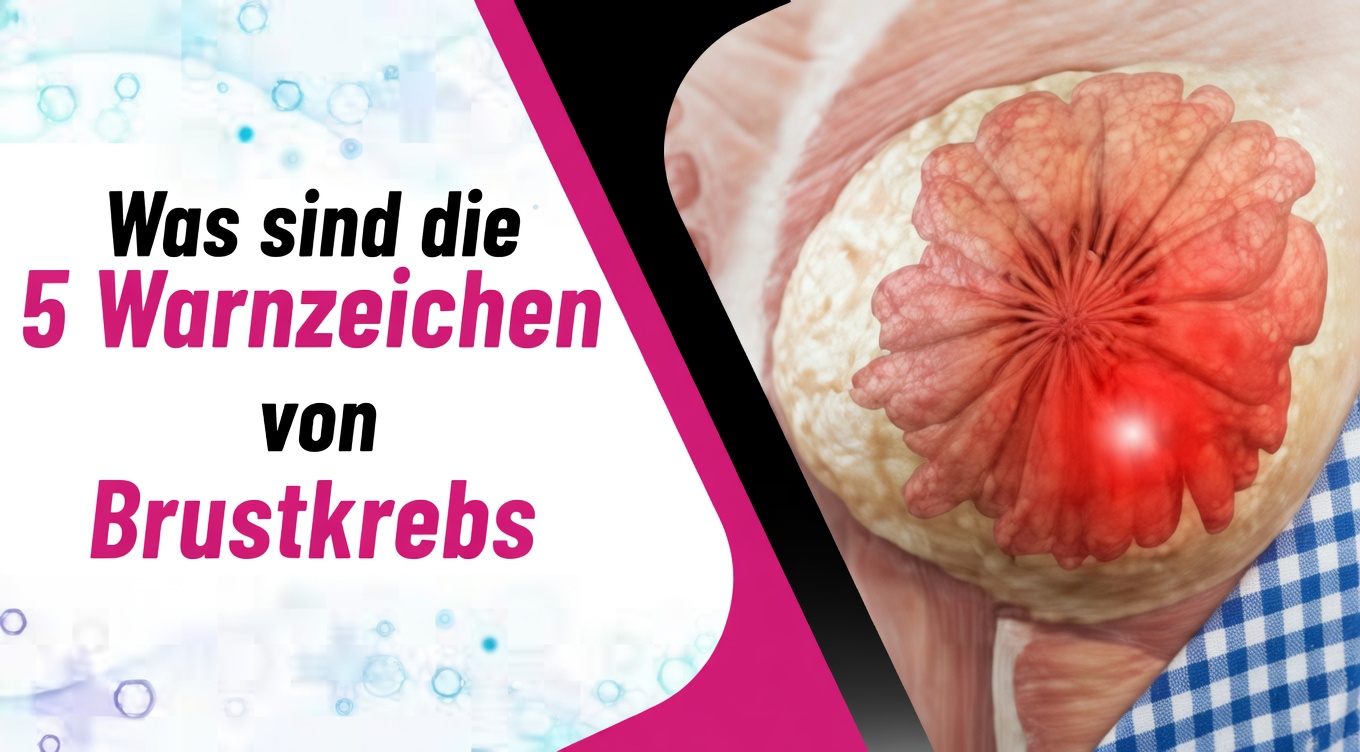 4 frühe Warnzeichen von Brustkrebs, die jede Frau kennen sollte