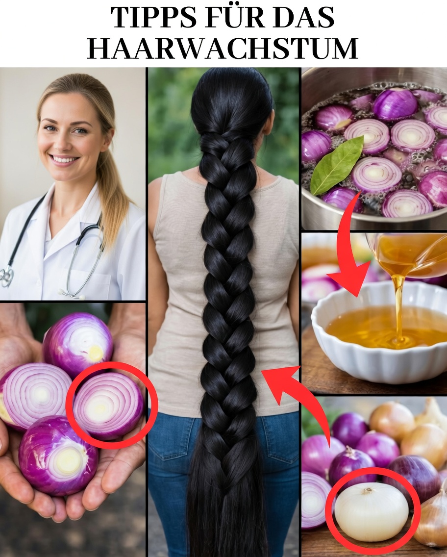 Nachts rohe Zwiebel auf die Kopfhaut reiben: das überraschende Haarritual, über das alle sprechen