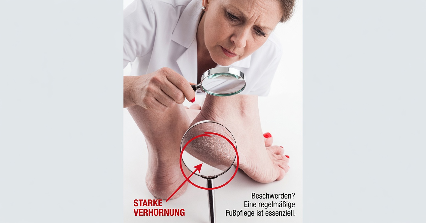 Aspirin gegen Hornhaut und Risse an den Füßen