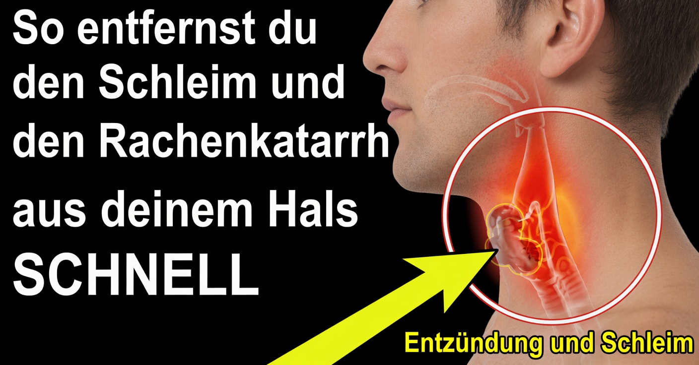 Schleim und Auswurf: Wirksame Hausmittel