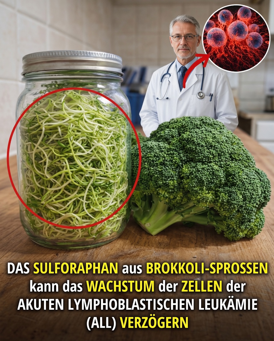 Kann eine Verbindung aus einem gewöhnlichen Gemüse neue Perspektiven in der Unterstützung bei akuter lymphoblastischer Leukämie eröffnen?
