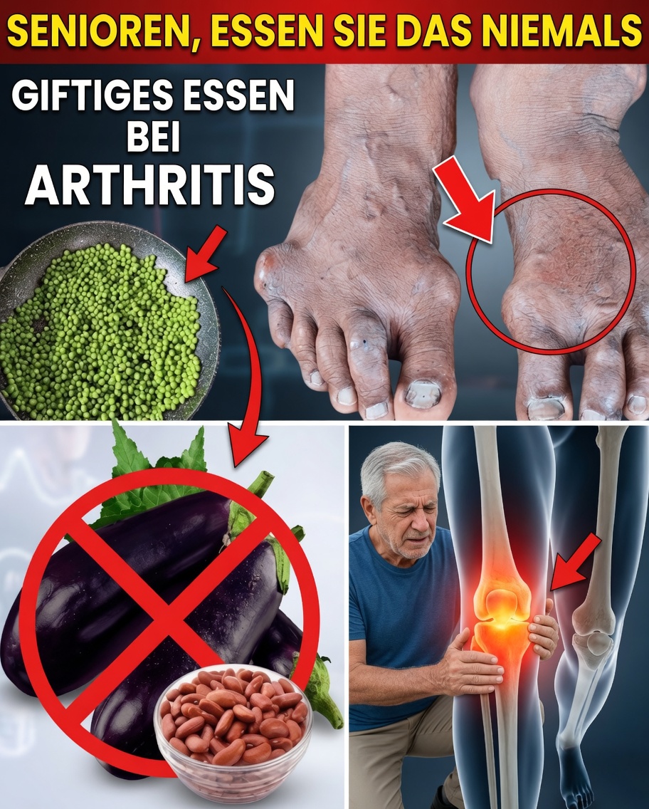 Senioren aufgepasst: 10 alltägliche Lebensmittel, die Ihre Arthritis-Schmerzen verschlimmern könnten