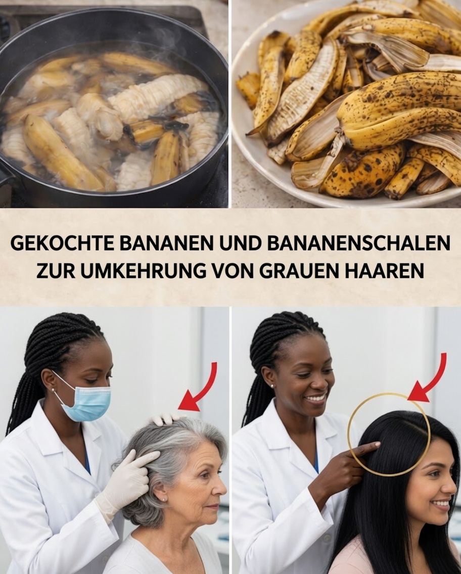 Werden graue Haare auf natürliche Weise wieder schwarz? Die Wahrheit über Bananenschalen zur Rückgängigmachung von grauen Haaren und zur Förderung des Haarwachstums