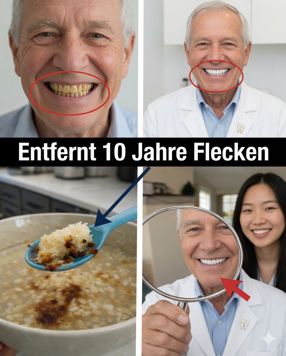 In 2 Minuten 10 Jahre Zahnverfärbungen entfernen? Die Wahrheit, die dich überraschen wird