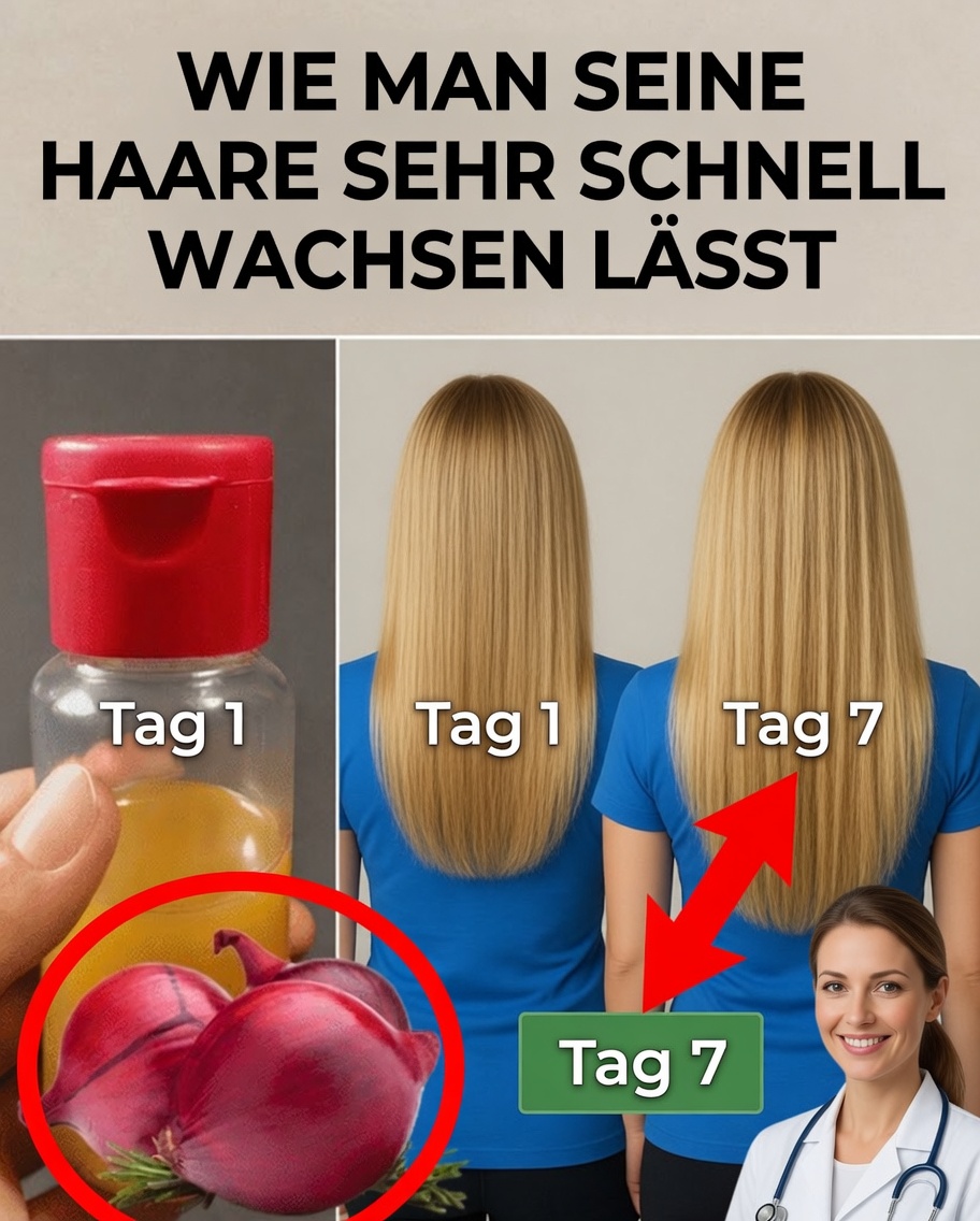 Wie man Zwiebelöl für schnelles Haarwachstum herstellt und Haarausfall stoppt