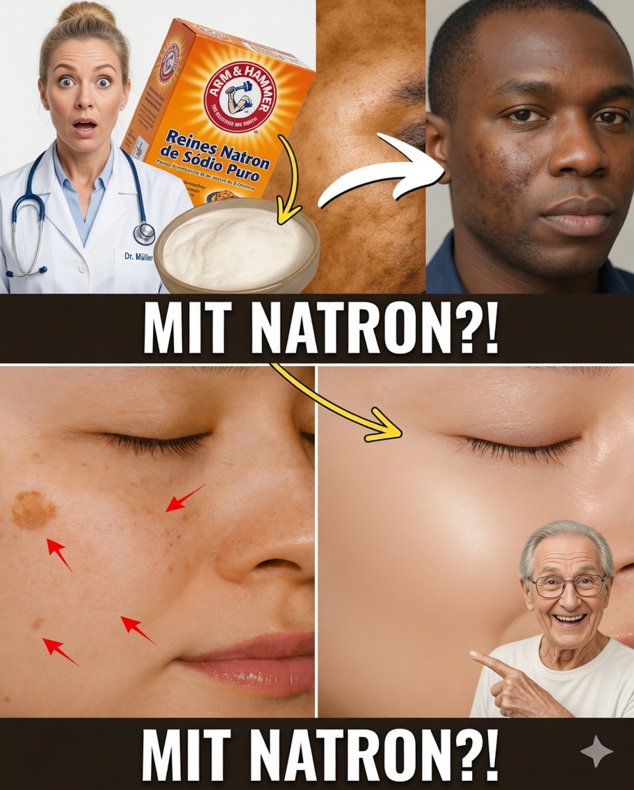 Hausgemachte Natroncreme gegen Falten und Flecken