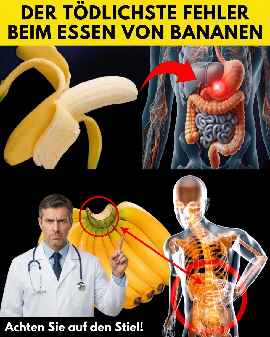 8 schwerwiegende Bananenfehler, die du vielleicht machst – und wie du sie auf natürliche Weise behebst