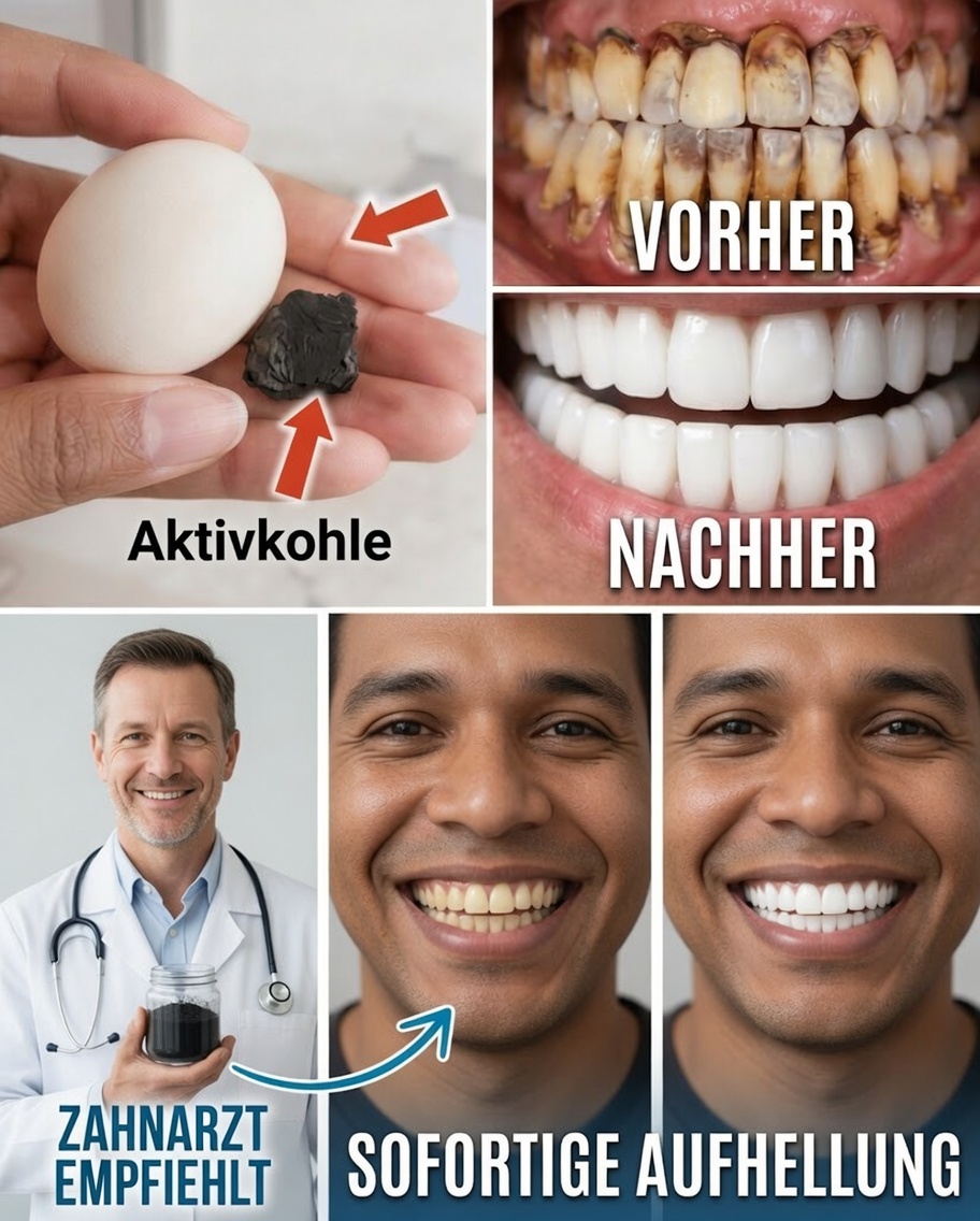 Eine einfache 3-Minuten-Zahnbürstroutine, um die Zähne zu Hause auf natürliche Weise aufzuhellen