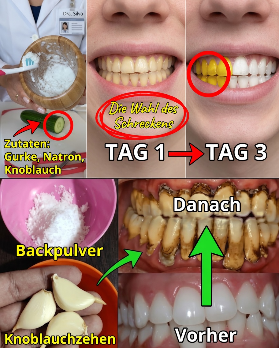 Lächle wie nie zuvor: Entdecke die Geheimnisse für ein umwerfendes Lächeln zu Hause