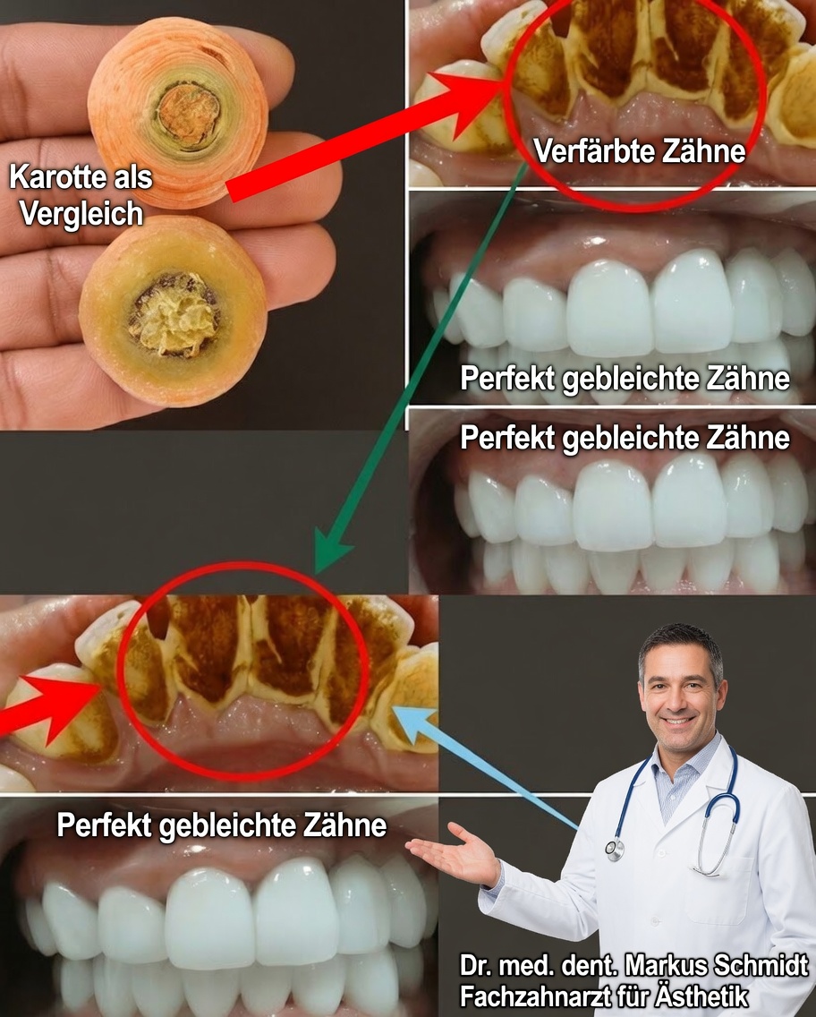 Stärken Sie Ihr Lächeln auf natürliche Weise: Kraftvolle Geheimnisse zum Schutz Ihrer Zähne und Ihres Zahnfleischs