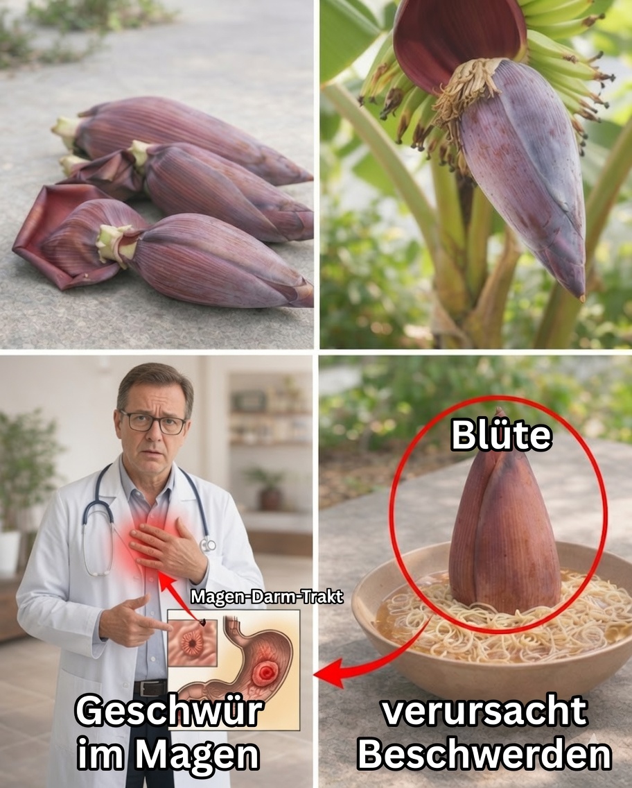 7 Überraschende Vorteile der Bananenblüte für die Gesundheit, die Sie kennen müssen
